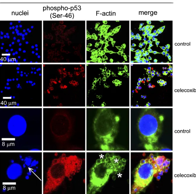 Fig. 5. The expression and localization of phospho-p53 (serine-46) proteins following treatment with celecoxib