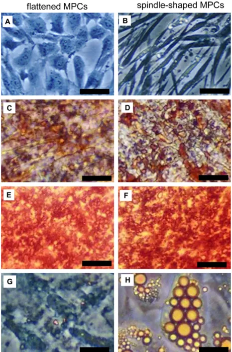 Fig. 1. Morphology and differentiation potentials of two types of clonogenic MPCs from umbilical cord blood