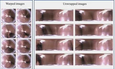 Fig. 10 Part of the duodenum images. The warped images were captured by RICE, and the unwrapped images (right) were obtained using polar coordinate conversion.