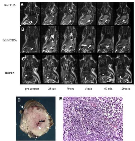 Figure 3. Sequential T1-weighted TFE images of a rat with implanted HCC before and after injection of 0.1 mmol/kg Gd-Bz-TTDA (A), Gd-EOB-DTPA (B), or Gd-BOPTA (C)