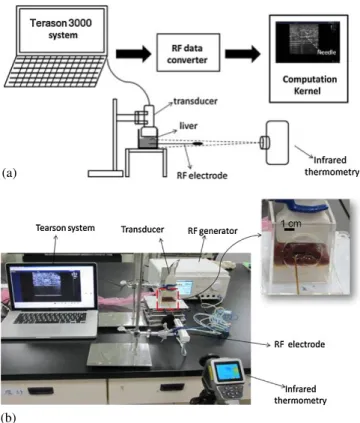 Figure 1 illustrates the experimental platform and method proposed to validate the reliability of ultrasound temperature imaging in monitoring RFA