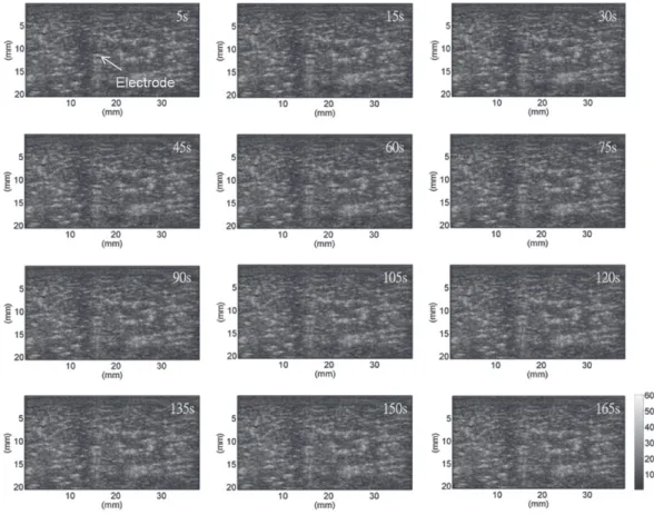 Fig. 3. (Color online) Ultrasound temperature images based on echo time-shift estimation of liver sample acquired at the various ablation times