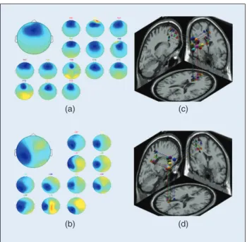 FIGURE 9  The scalp maps and equivalent dipole source locations 