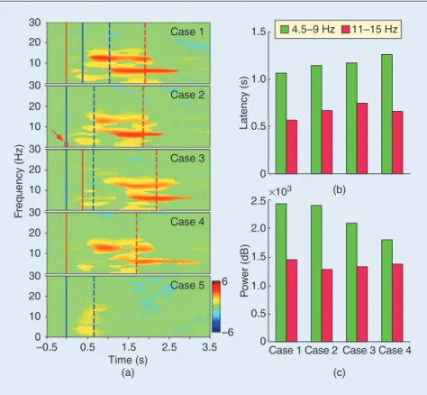 FIGURE 10 (a) The ERSP images of frontal cluster for five cases. The right column showed the  onset sequences of two tasks