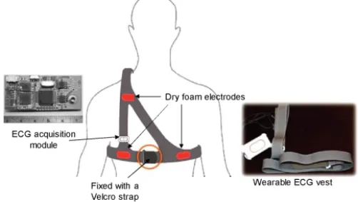 Fig. 5. Flowchart of ECG monitoring MIDlet program.