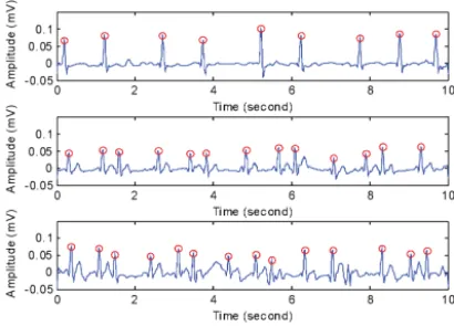 Fig. 8. (a) Frequency characteristic of proposed dry foam electrodes and (b) impedance variation of dry foam electrode and wet electrode under long-term ECG measurement.