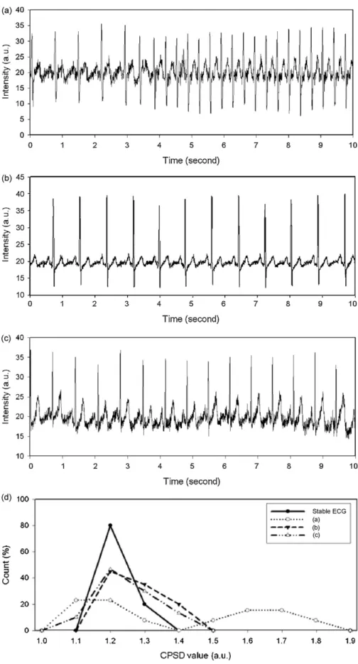 Fig. 6. Effects of intra-variability on CPSD results for three common normal ECG signals