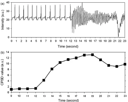 Fig. 7. Continuous evaluation of VF signals by CPSD algorithm yields updated every second