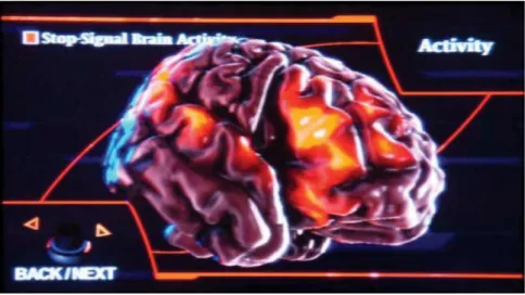 Figure 1. Screenshot showing the 3D effects of the brain