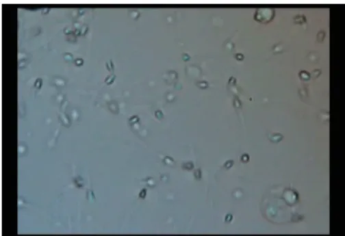Fig. 5. (a)The image of sperms. 