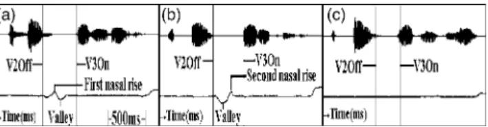 TABLE I. Nasal patterns categorized according to boundaries and contexts. “I,” intonational phrase boundary; “W,” word boundary; “S,” syllable boundary; RVR, first nasal rise followed by a nasal valley 共inhalation兲, and then a second nasal rise; RV, first 