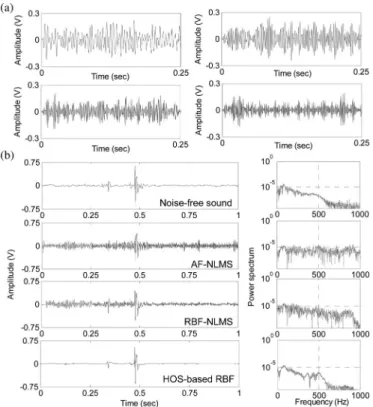 Fig. 4. Performance comparison for enhancing noisy bowel sounds corre- corre-sponding to different learning rates by using different methods.