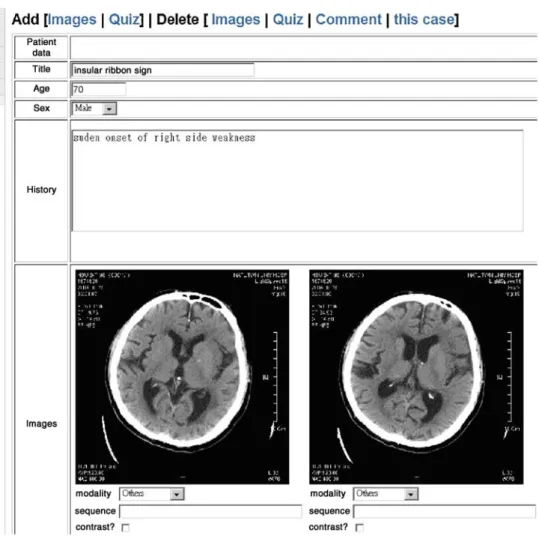 Fig 3. Case editing page shows that information is retrieved from the DICOM attributes, and users can modify this information before storing in the database.