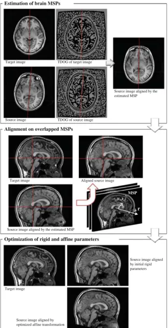 FIGURE 2. Flowchart of the proposed affine registration method. The brain MSPs in the source and target images are determined according to the TDOG images and are then overlapped together