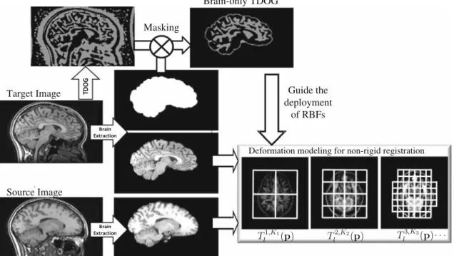 FIGURE 6. Flowchart of the proposed non-rigid registration method. Non-brain regions of the target brain are first removed to obtain a brain mask, which is then used to extract the brain region in the TDOG image of the target brain and construct the  brain