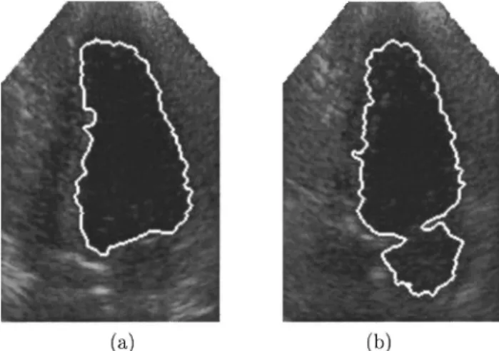Fig. 8 (a) and (b) are two echocardiographic images with the boundaries obtained by the proposed approach.