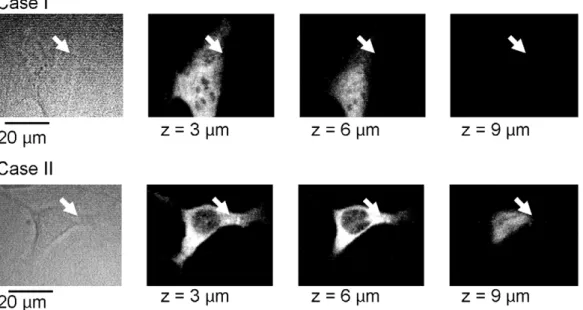 Fig. 3. Morphological change of the cellular membrane monitored by a high-speed imaging