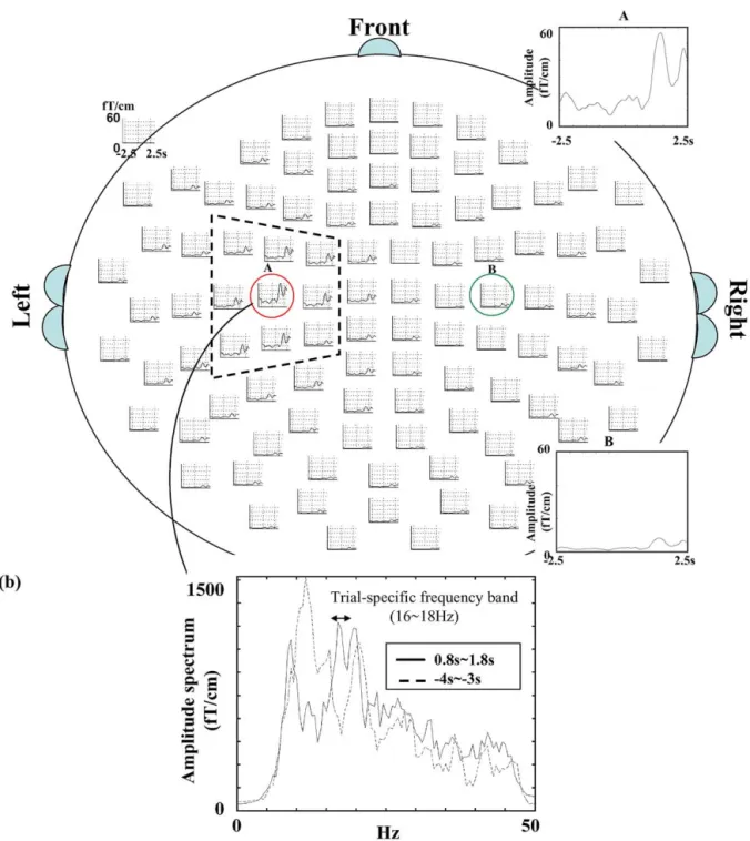 Fig. 6. Sensor-array display of VAMW recon s and VAMWs. (a) One example of ICA single-trial VAMW recon s of all sensor sites in subject I