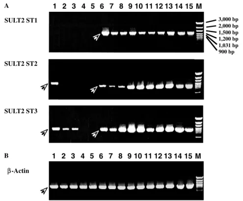 Fig. 5. Developmental stage-dependent expression of the zebraWsh SULT2 STs. (A) RT-PCR analysis of the expression of mRNAs encoding SULT2 ST2 and ST3, as well as the previously identiWed zebraWsh SULT2 ST1, at diVerent stages during embryogenesis and larva
