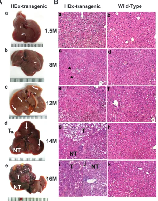 Fig. 1. Hepatocarcinogenesis in HBx transgenic mice. (A) Representative photographs of the gross liver morphology in HBx transgenic mice at different times after birth