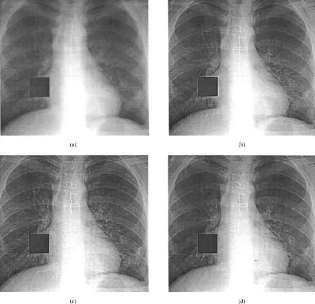 Fig. 12. Results of contrast enhancement for test image Fig. 2(d): (a) original, (b) the CGT algorithm, (c) the IPLSD algorithm, and (d) the proposed algorithm.