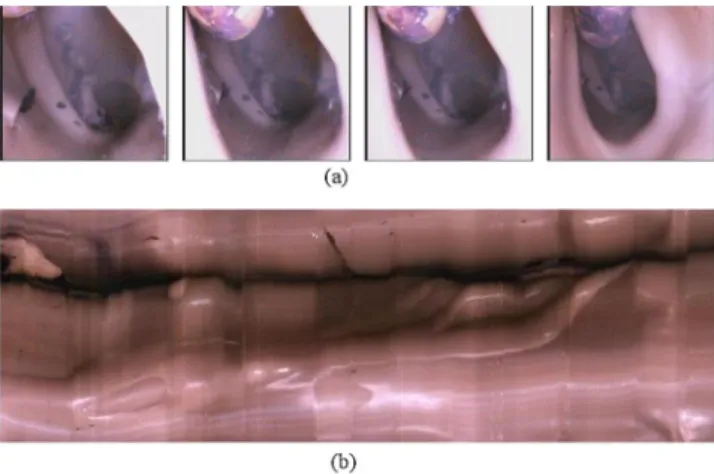 Fig. 16 Image reconstruction of duodenum (a) full view and (b) the zoom-in view of the block.