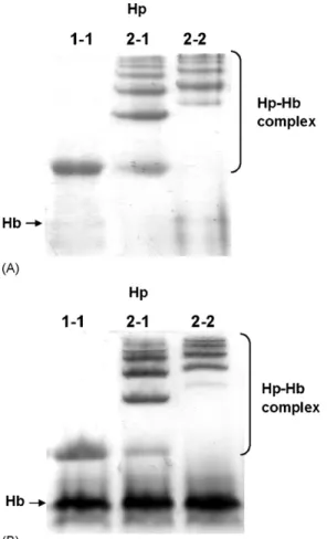 Fig. 7. Analysis of hemoglobin-binding property of isolated Hp 1-1, 2-1, and 2-2 (A) and Hp 1-1, 2-1, and 2-2 from human plasma (B) on 7%  native-PAGE