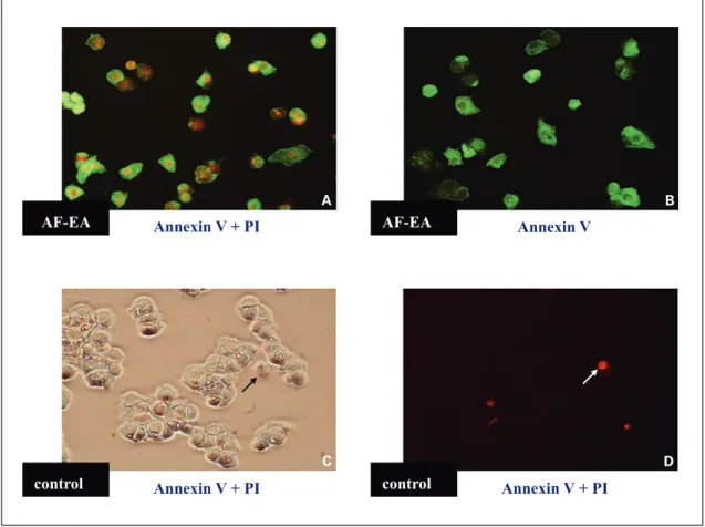 Fig. 2.  Microscopic examination of normal versus EA fraction-treated MCF-7 cells in culture, as stained with Annex- Annex-in-V and PI