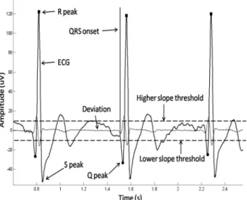 Fig. 3. QRS detection in the normal ECG waves. The black curve means the normal ECG signal which contains three waves
