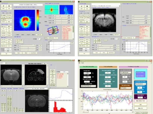 Fig. 2. Interface for analyzing PET, MRI, and electrophysiological recording data.