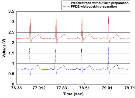 Figure 10. ECG signals detected by the proposed FPDE and wet electrodes. 