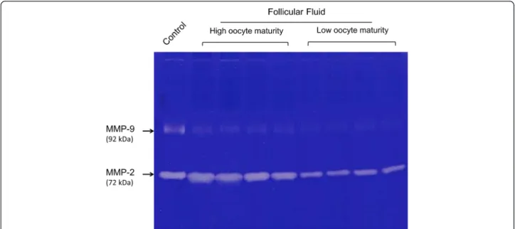 Fig. 1 Representative MMP-2 and MMP-9 zymography gel of human follicular fluids. Zymography assay was performed as described in the section of Materials and Methods