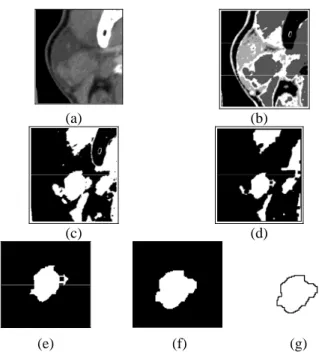 Table 1.  Extracted blobs of suspected tissue regions and the GSFs. 