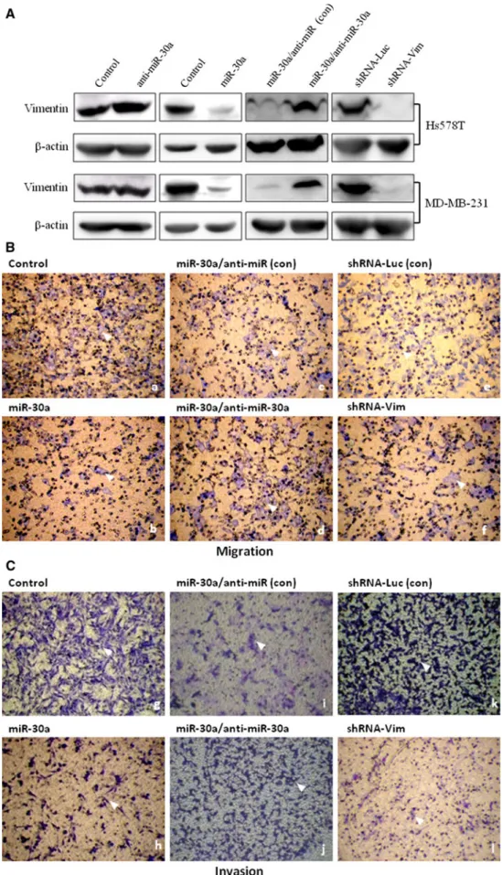 Fig. 4 Inhibitory effect of miR- miR-30a on the migration and invasiveness of breast cancer cell lines