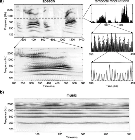 FIG. 4. Examples of auditory spectrograms 关y final 共t,x兲兴 for speech and music stimuli