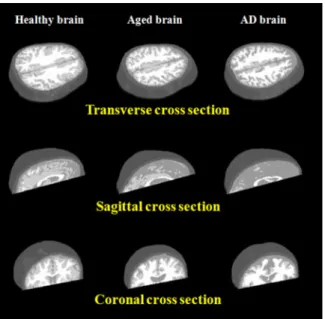 Fig. 4. Source–detector separations on human head arranged as (a) transverse and sagittal views, and (b) coronal view.