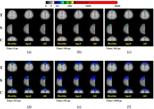 Fig. 6. Dynamics of photon migration in Transverse (T), Sagittal (S), and Coronal (C) views with 800-nm light illumination: (a) at time = 0 ps, (b) at time = 104 ps, (c) at time = 161 ps, (d) at time = 312 ps, (e) at time = 611 ps, and (f) at time = 1000 p