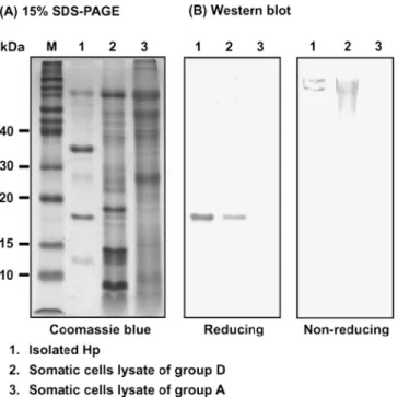 Figure 1. Typical SDS-PAGE pattern and Western blot analyses of milk somatic cell lysates from groups A and D