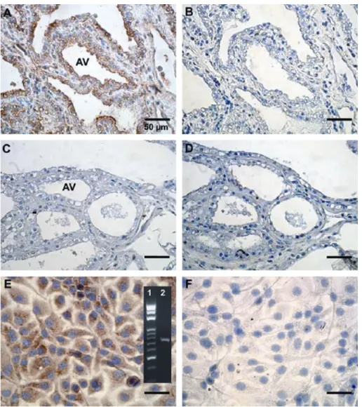 Figure 5. Immunocytochemical localization of Hp in mammary gland and MAC-T cells. Mammary tissues with (A and B) and without mastitis (C and D) were incubated with mouse anti-Hp polyclonal antibodies (A and C), while using normal non-immuned mouse serum as