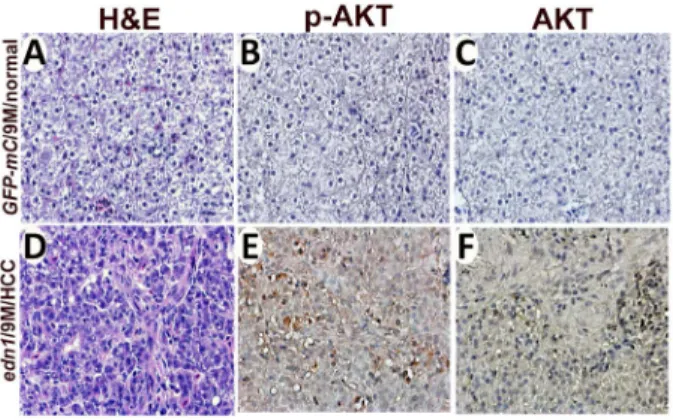 Figure 8. Expression of p-AKT and AKT in the edn1 transgenic fish. (A) and (D) depict H&amp;E staining of the liver sections of the  GFP-mCherry control and edn1 transgenic fish