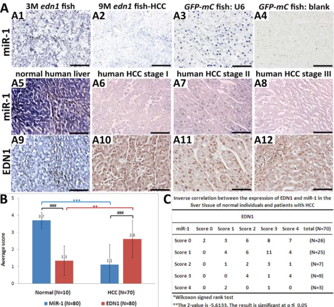 Figure 9. MiR-1 regulates EDN1 expression in HCC. (A) The RNA expression of miR-1 in the edn1 transgenic fish and human specimens was determined by in-situ hybridization, and EDN1 protein expression in human specimen by IHC