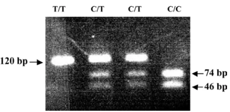 Fig. 1. Electrophoresis of different genotypes of transforming growth factor beta 1-509.