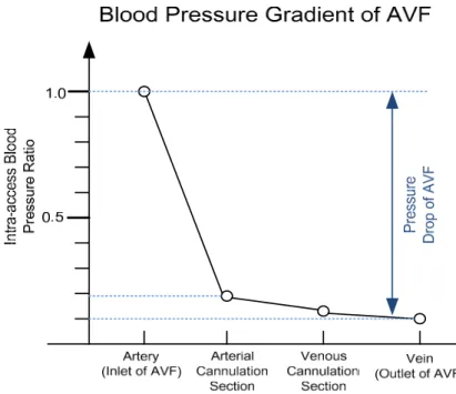Figure 1. The blood pressure gradient of arteriovenous fistula (AVF), where it can be observed that  there is a severe blood pressure drop (>90% decrease) across AVF (based on Reference [1])