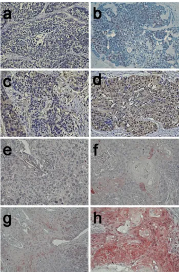 FIG. 1 Representative examples of NBS1 and Snail immunohisto- immunohisto-chemical stains
