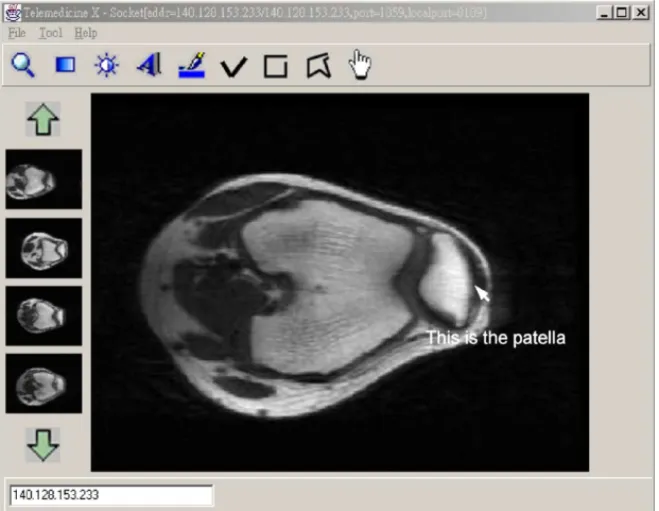 Fig. 1 A displayed MR knee image during consultation. The synchronous cursor or pointer is pointing out the patella.