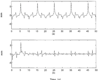 Fig. 12 Position errors in Z -axis using „ a … sliding mode con- con-trol and „ b … the present method