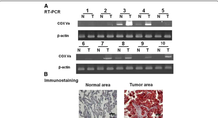 Figure 8 Molecular expression and immunostaining of COX Va in pairs of surgically resected lung tissues from 10 patients with NSCLC