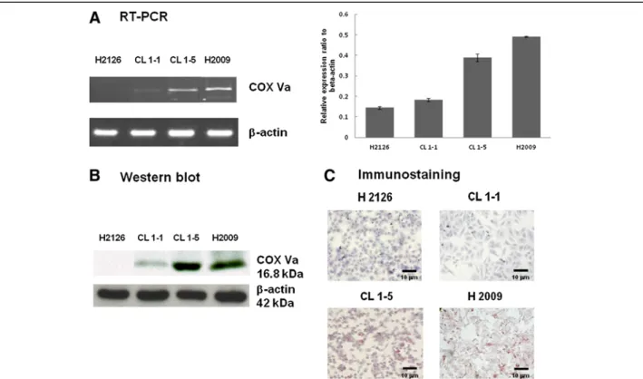 Figure 4 Comparison of the expression of mRNA and protein of COX Va in NSCLC cell lines using RT-PCR, western blot and