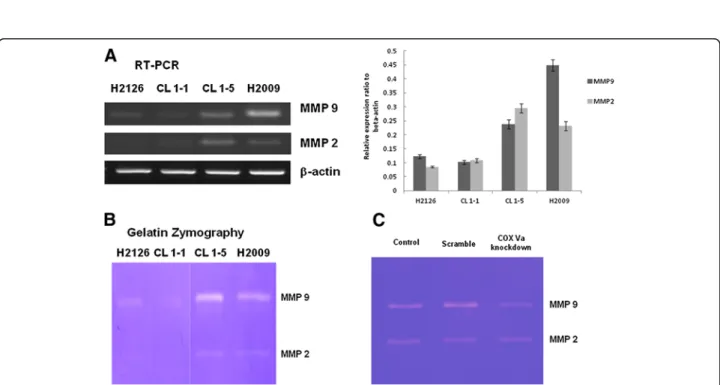 Figure 6 Studies of MMP-2 and MMP-9 in NSCLC cells. (A) RT-PCR for MMP-2 and MMP-9 in four NSCLC cell lines