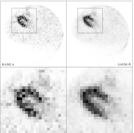 Figure 7. Male human cardiac SPECT study. The log-likelihood level of the images is